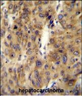 IHC-P - ACF Antibody (C-term) AP10670b